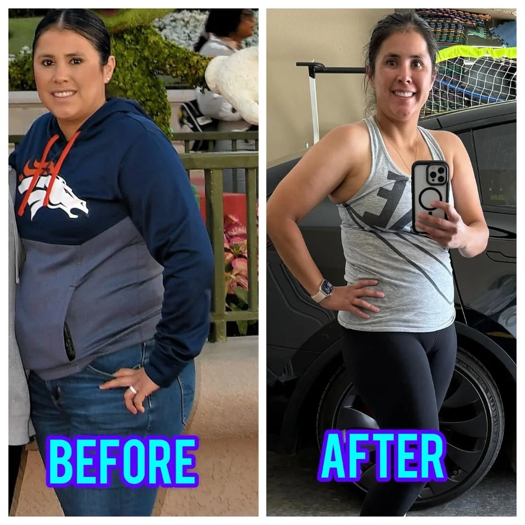 Before-After (10)