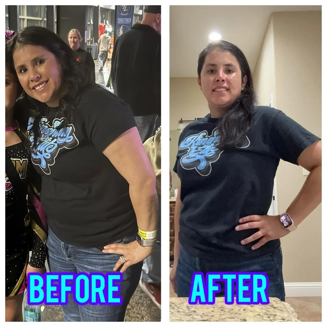 Before-After (11)