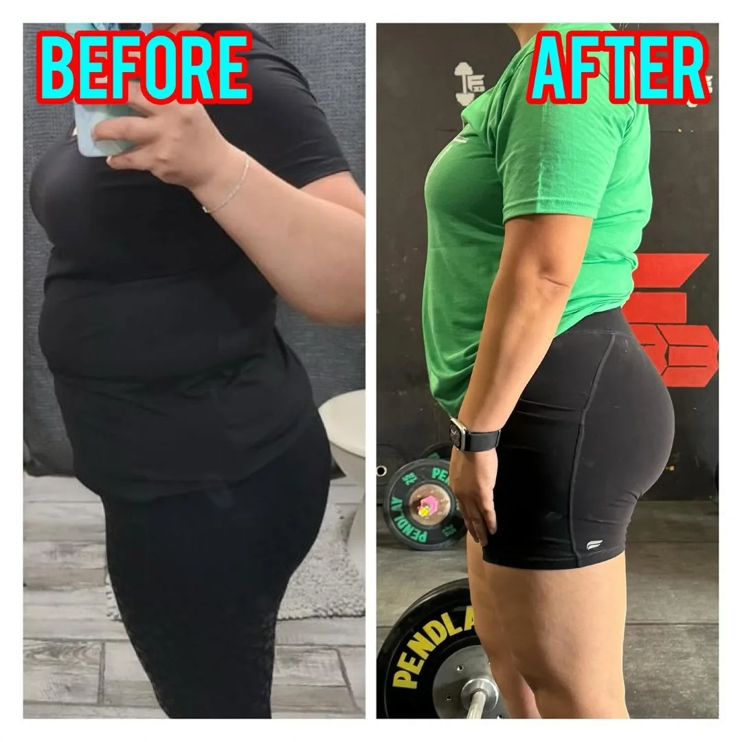 Before-After (12)