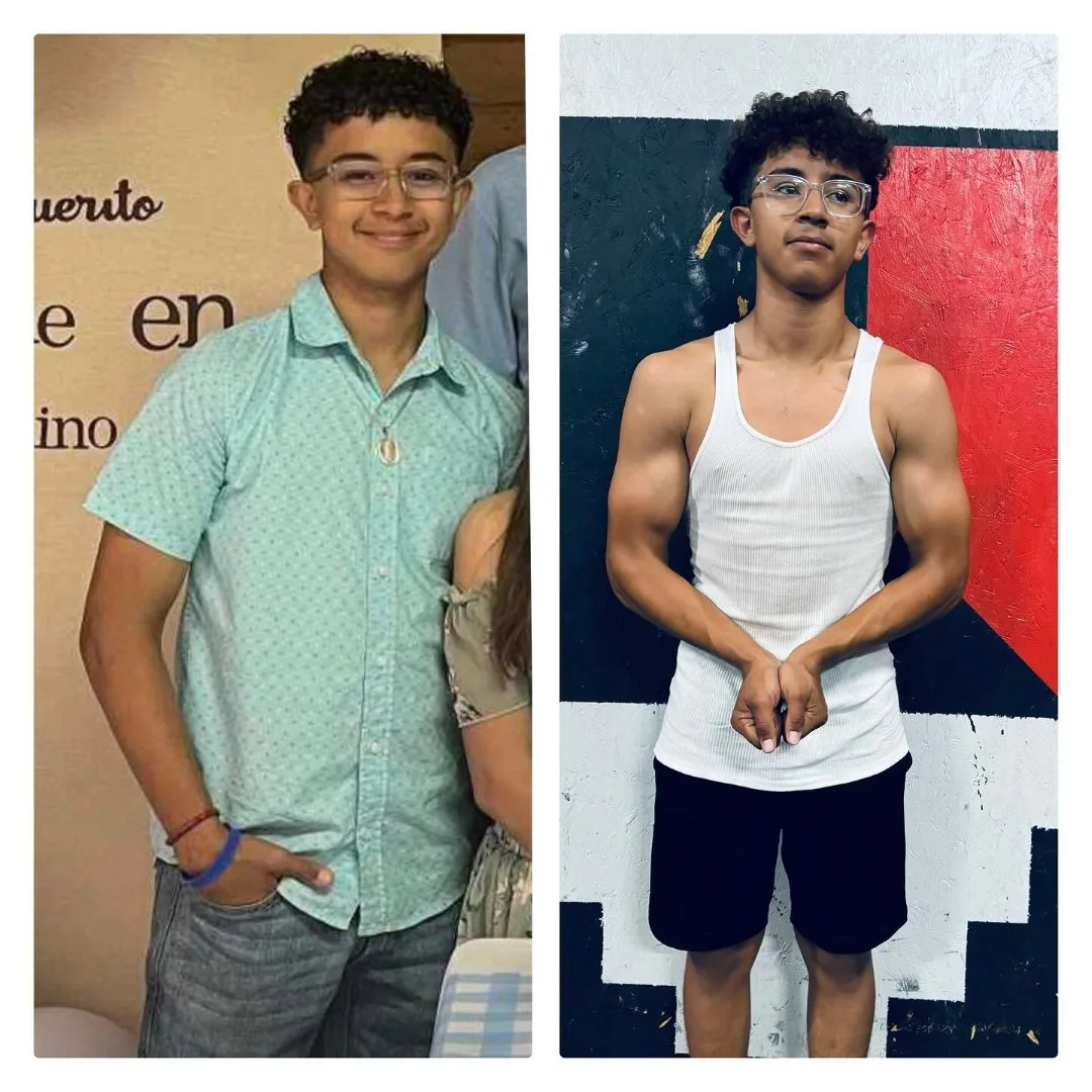 Before-After (13)