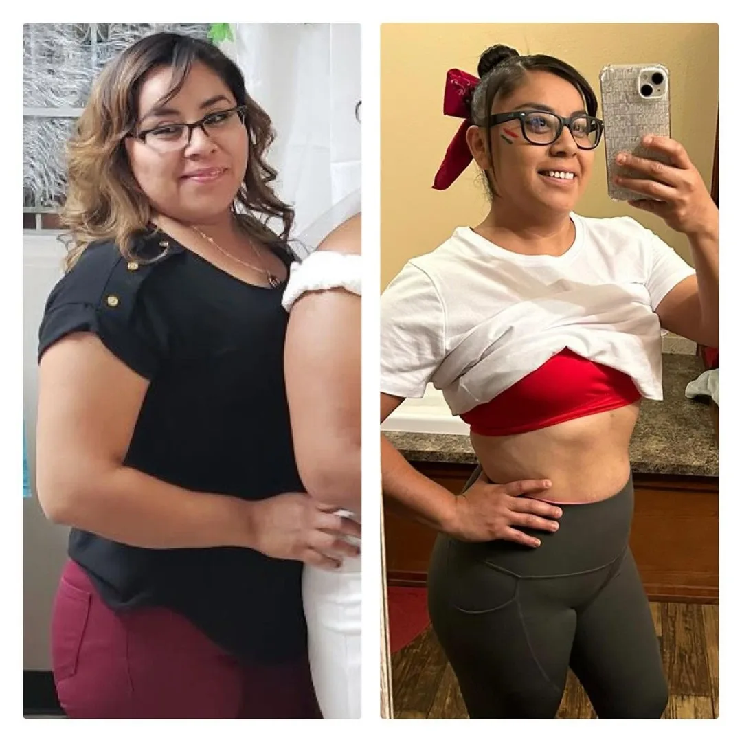 Before-After (14)