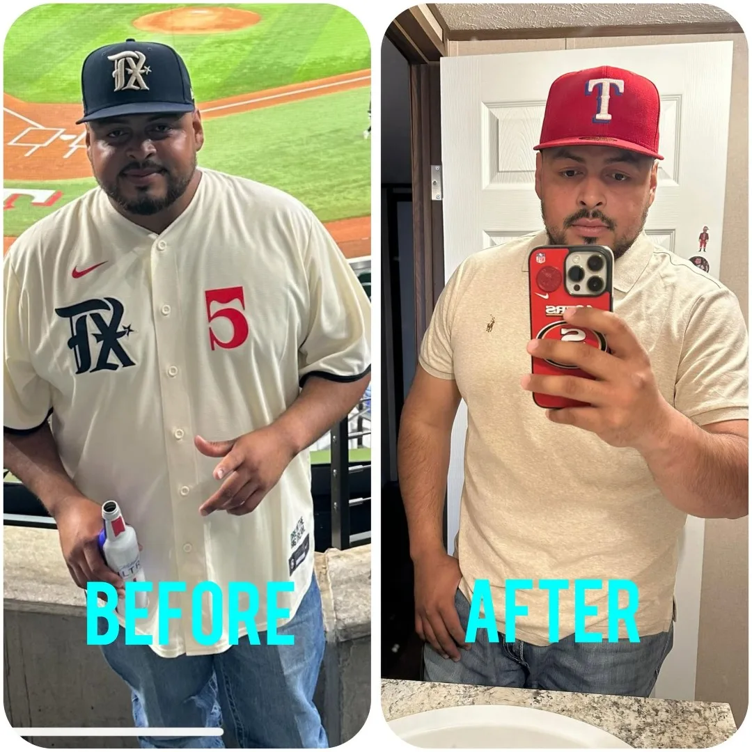 Before-After (16)