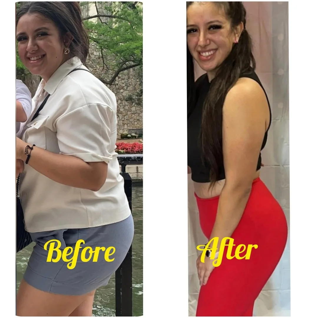Before-After (17)