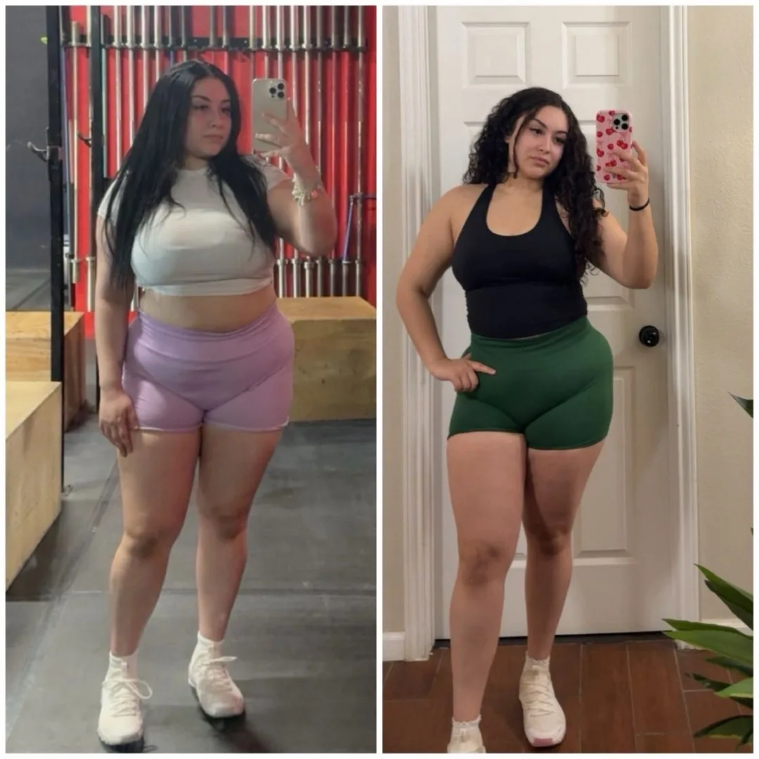 Before-After (2)