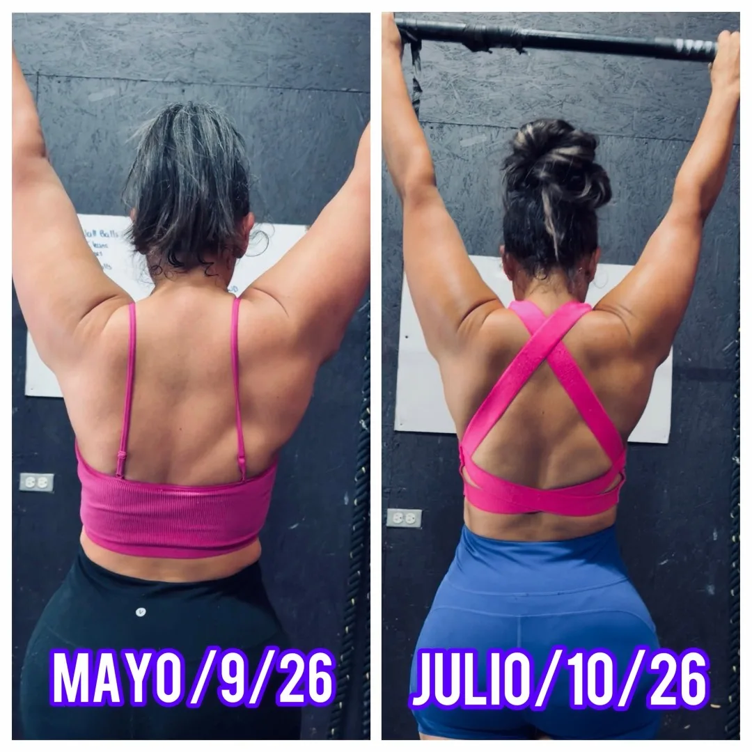 Before-After (3)