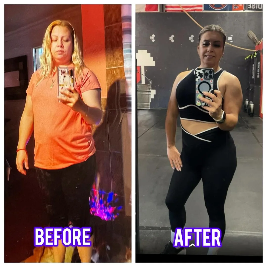 Before-After (5)