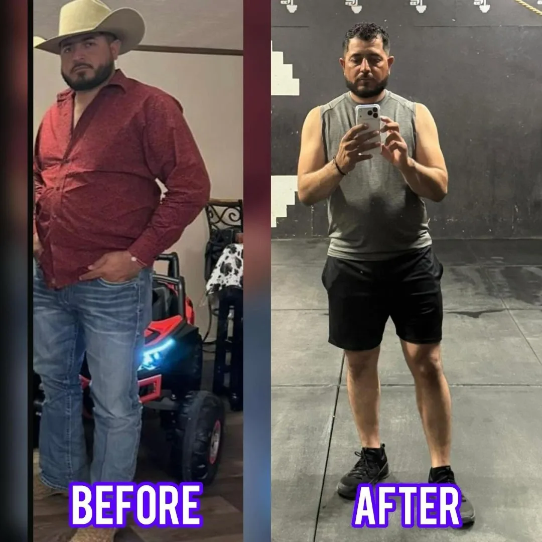 Before-After (6)