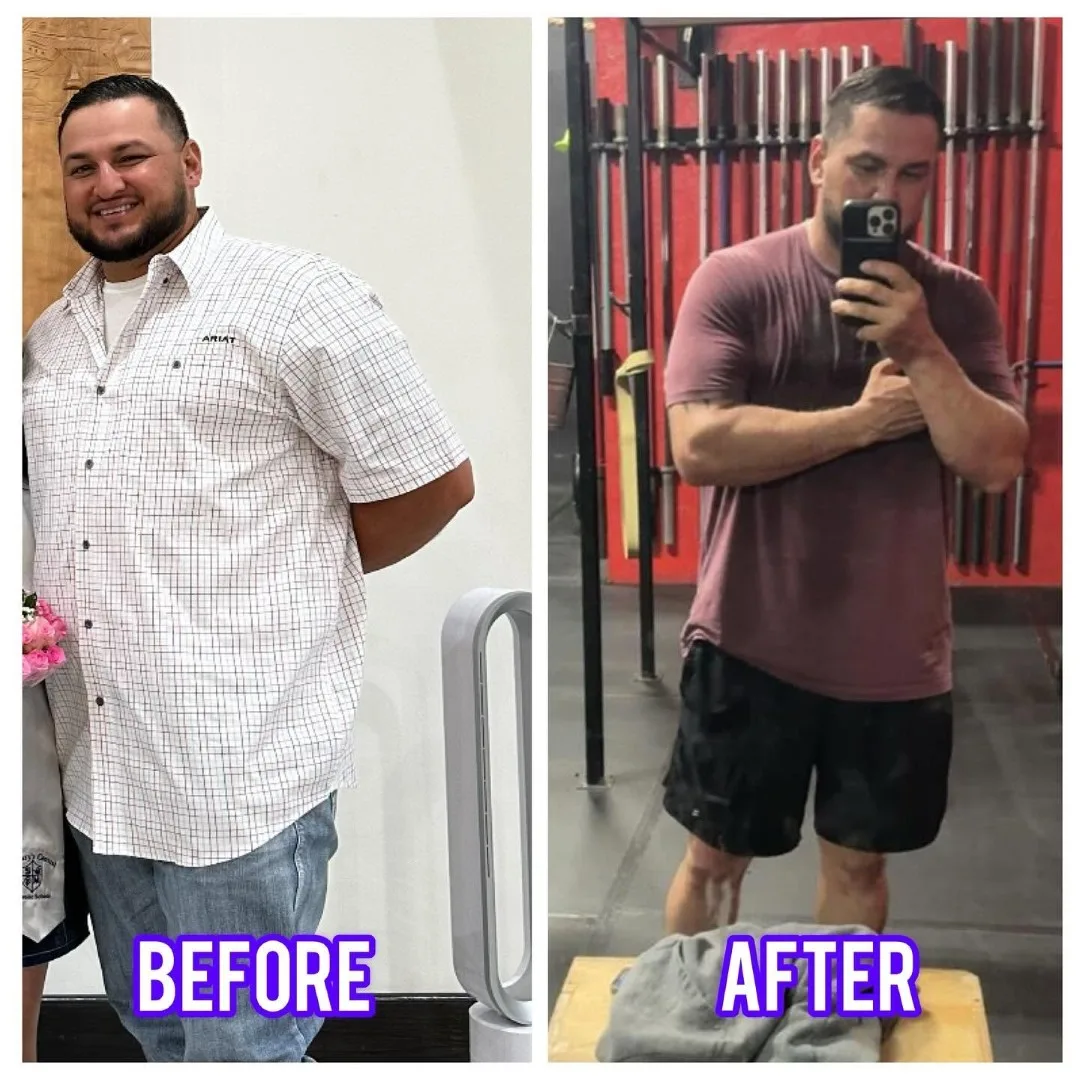 Before-After (7)