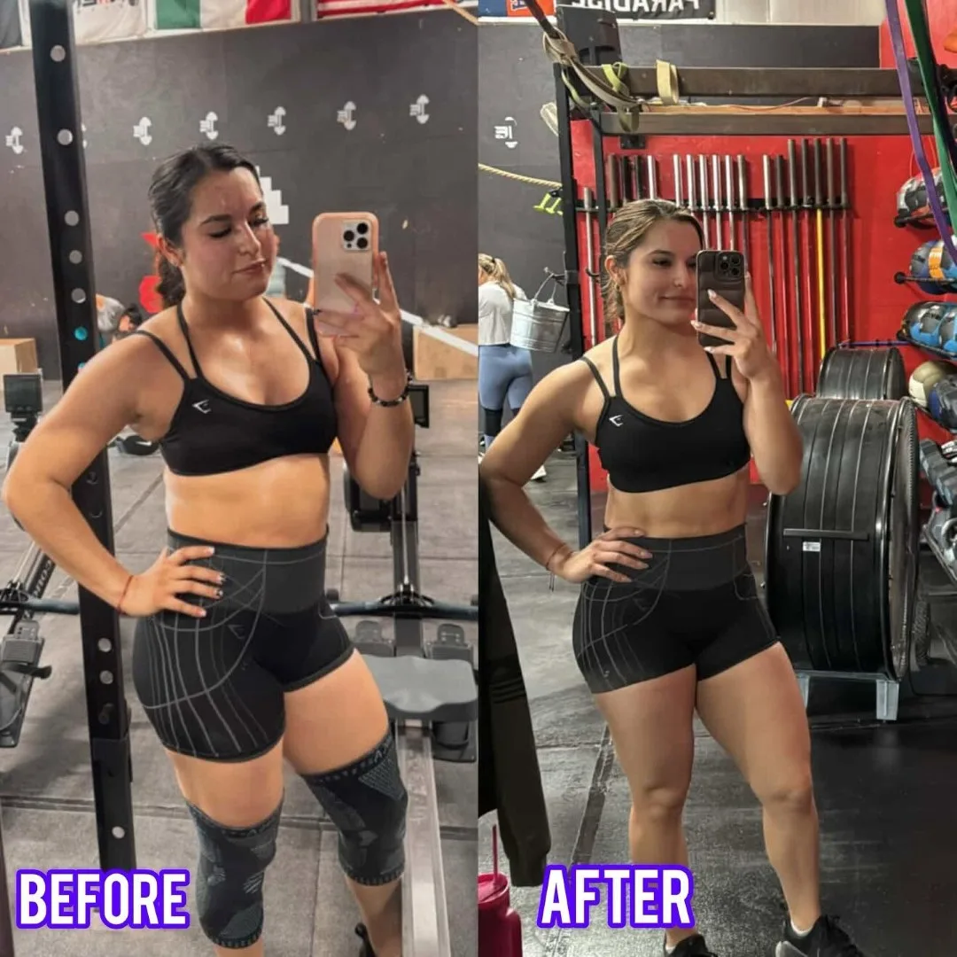 Before-After (8)